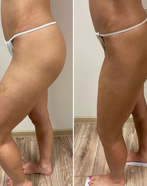 Solution Spray Tan Pro Dark Ash